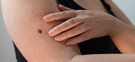 Regular Skin Checks - Your Key to Early Detection